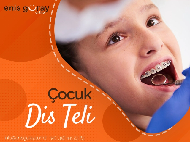 Çocuk Diş Teli