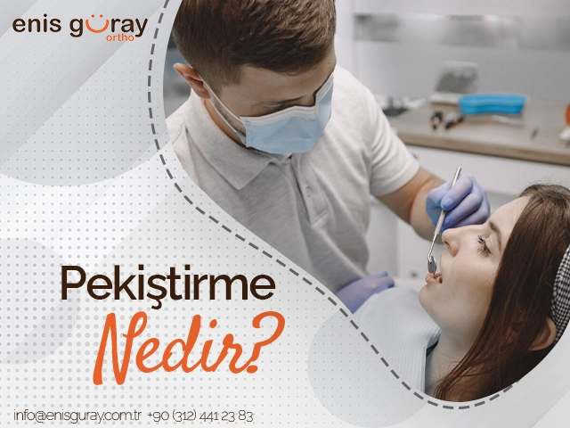 Pekiştirme Nedir?