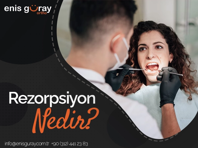 Rezorpsiyon Nedir?