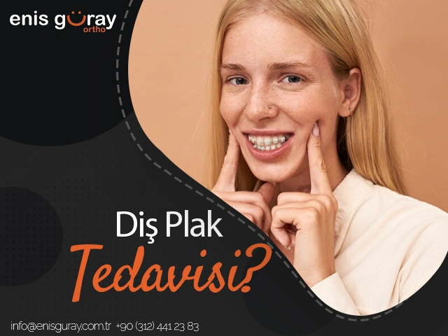 Diş Plak Tedavisi