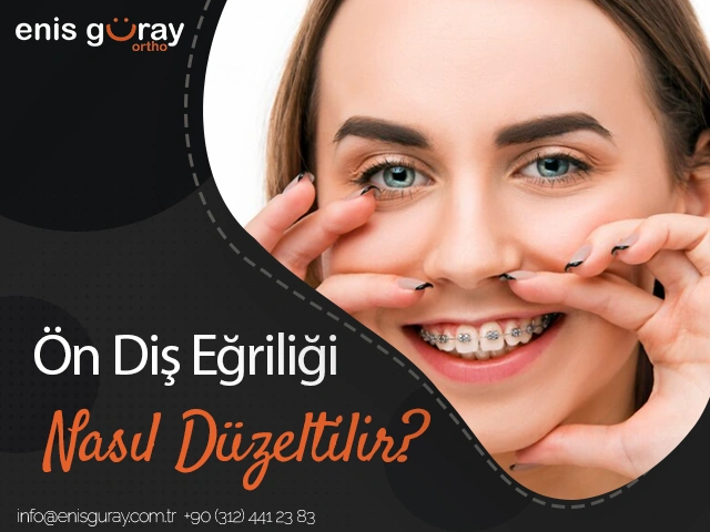 Ön Diş Eğriliği Nasıl Düzeltilir?