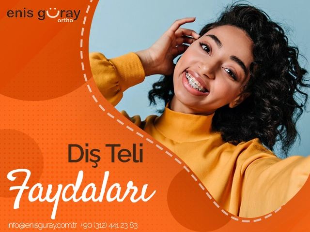 Diş Teli Faydaları