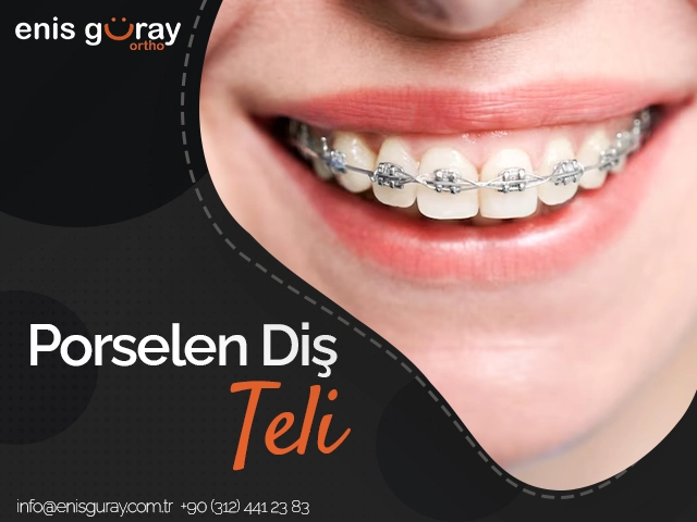 Porselen Diş Teli