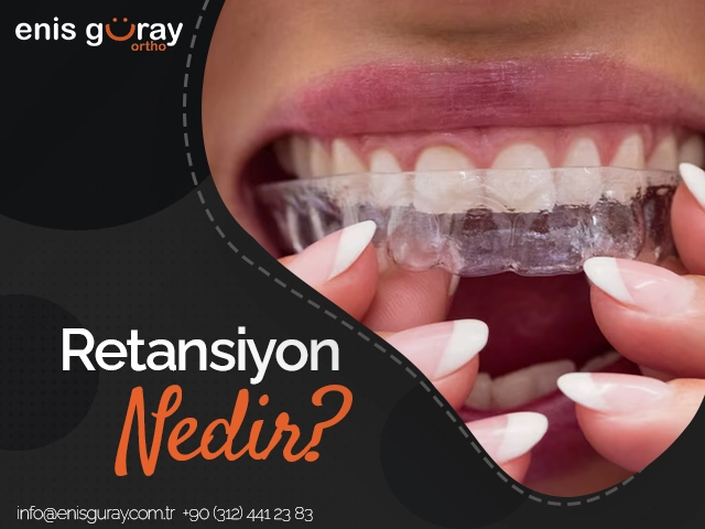 Retansiyon Nedir?