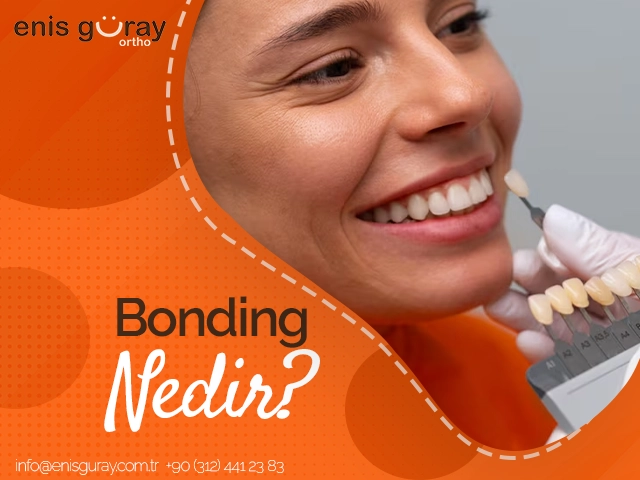 Bonding Nedir?