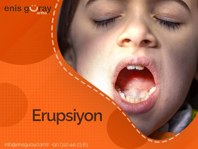 Erupsiyon
