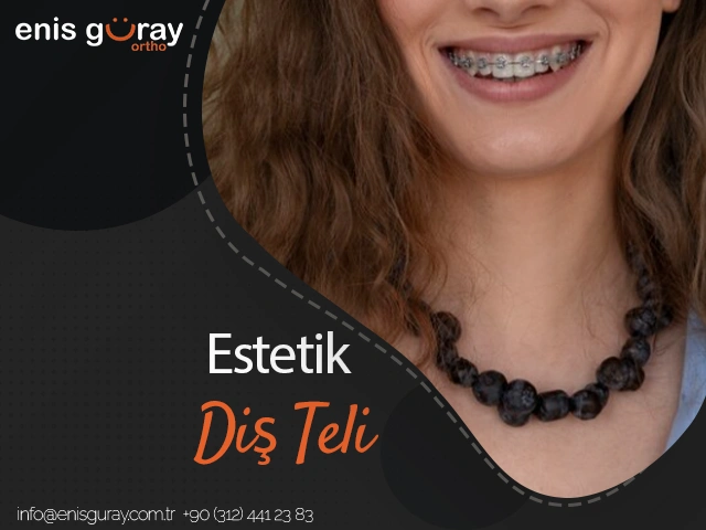 Estetik Diş Teli