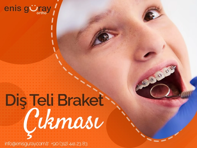 Diş Teli Braket Çıkması