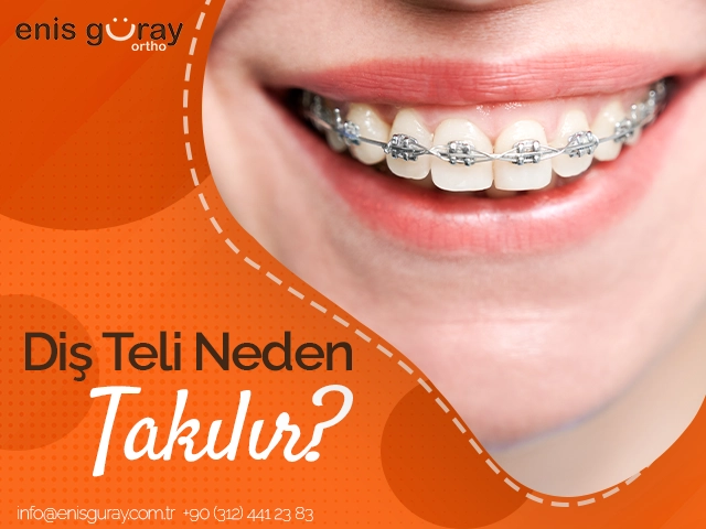 Diş Teli Neden Takılır?