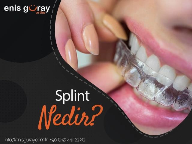 Splint nedir?